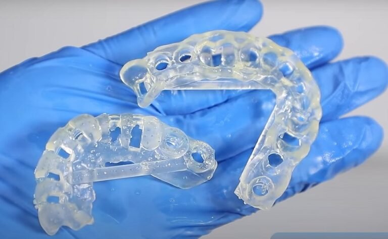 Dentist using a 3D printed surgical guide during dental implant procedure